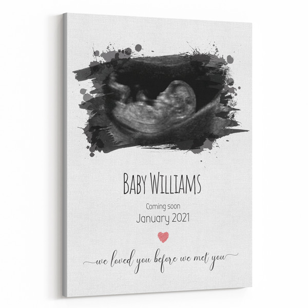 We Loved You Before We Met You Photo Baby Canvas Print